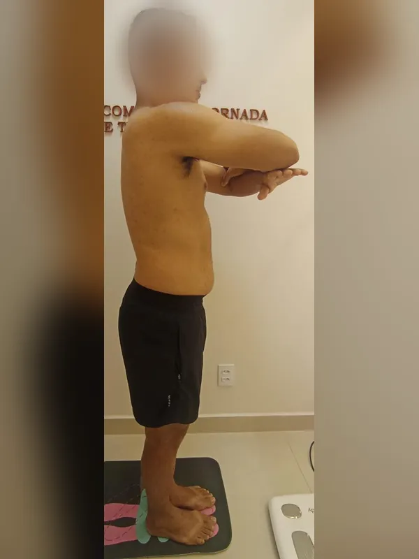 Antes: paciente 1, de perfil