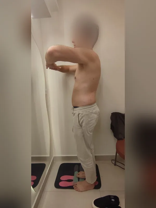 Antes: paciente 2, de perfil