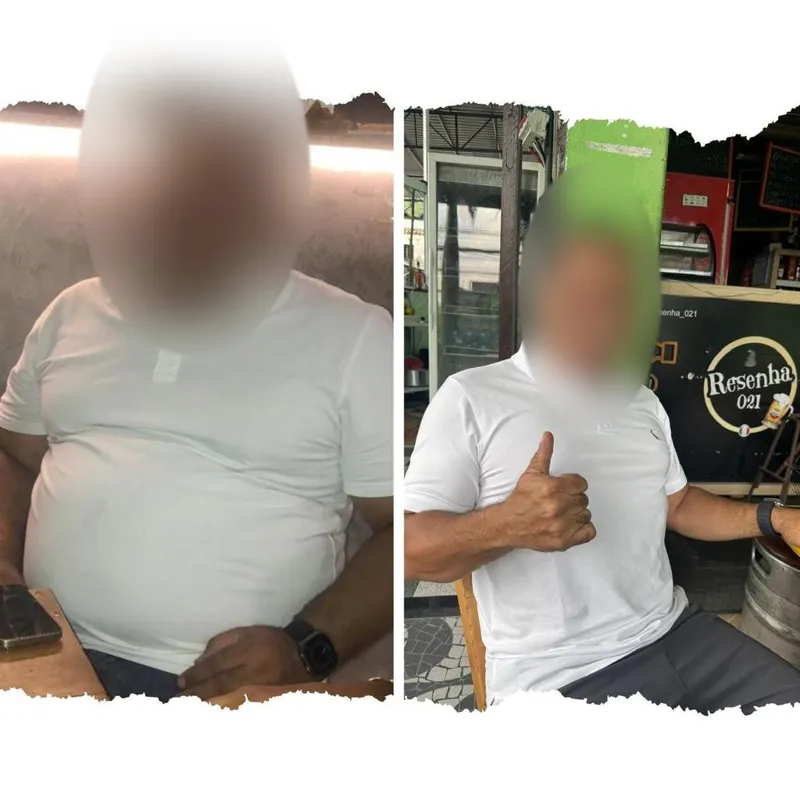 Paciente 3, antes e depois